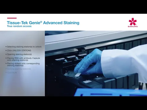 youtube-video-thumbnail