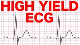 Electrocardiograms (ECG) Made Easy!