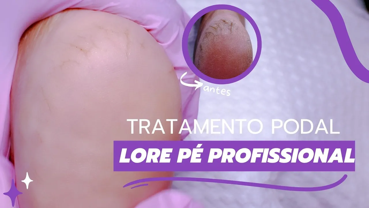 Video de LorePé