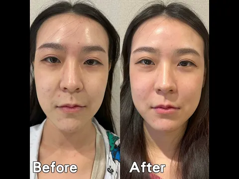 youtube-video-thumbnail