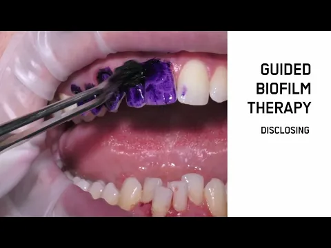 youtube-video-thumbnail