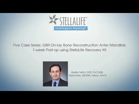 5 Case Series of accelerated healing after 5 different dental surgeries - by Dr. Walter Tatch, Oral & Maxillofacial Surgeon