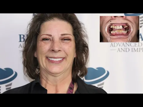 youtube-video-thumbnail