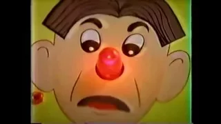 Hasbro's Operation Board Game Commercial