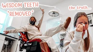 I GOT MY WISDOM TEETH OUT *VLOG* (the truth about this surgery)