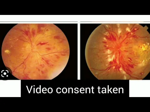 youtube-video-thumbnail