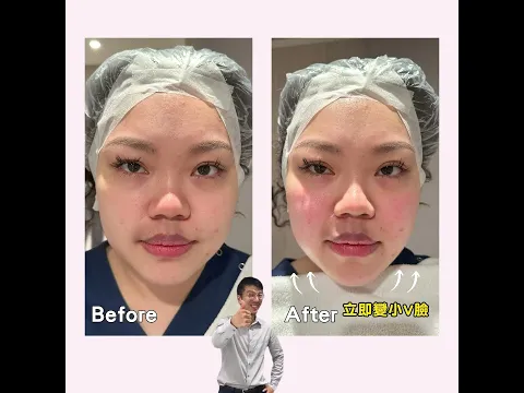 youtube-video-thumbnail