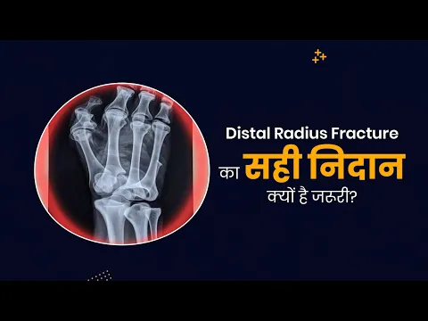 youtube-video-thumbnail