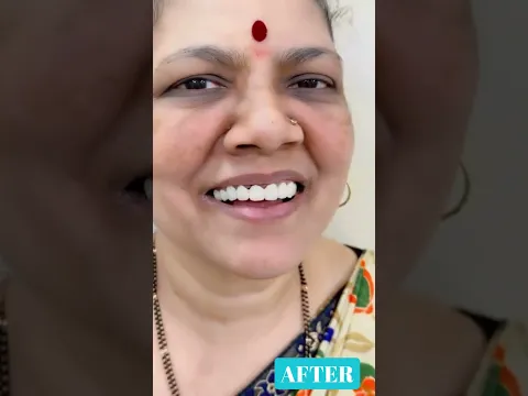 youtube-video-thumbnail