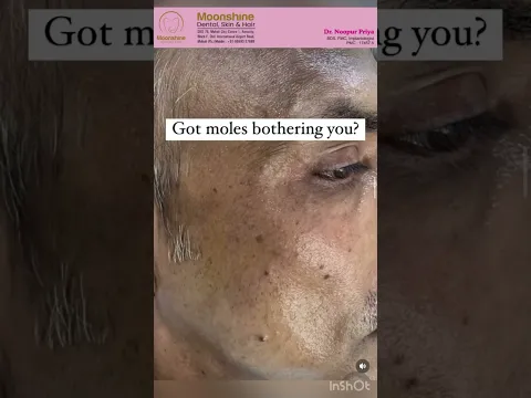 youtube-video-thumbnail