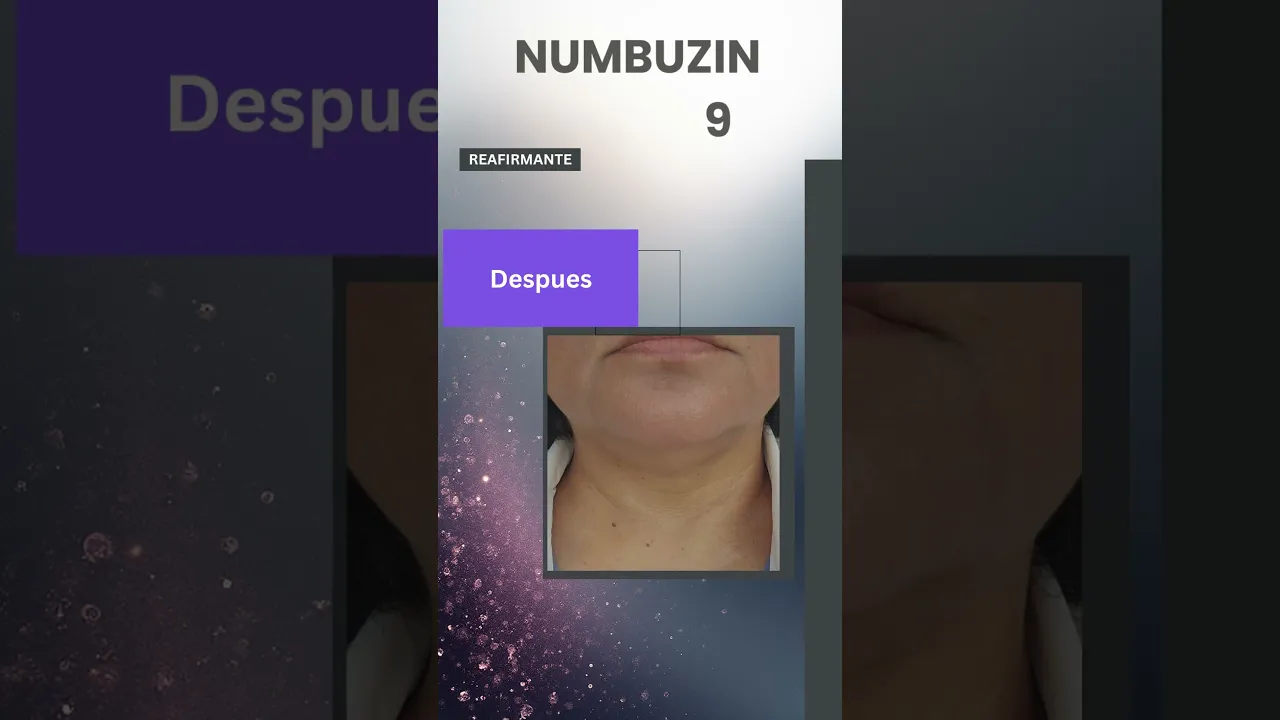 Video de BioVance Mexico