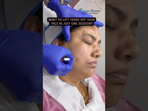 youtube-video-thumbnail