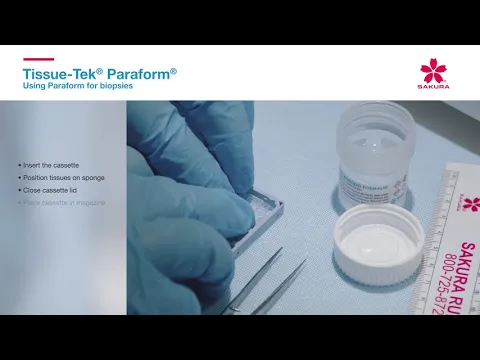 youtube-video-thumbnail