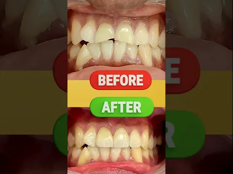 youtube-video-thumbnail