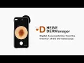 HEINE DELTA 30 PRO Dermatoscope - Bundle video