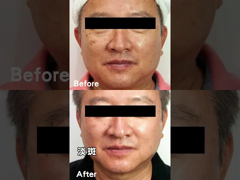 youtube-video-thumbnail