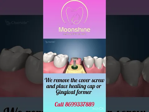 youtube-video-thumbnail