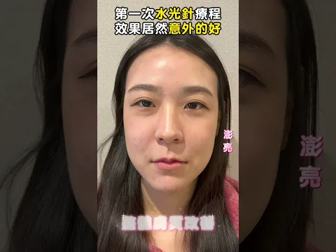 youtube-video-thumbnail